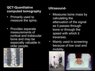 QCT-Quantitative
computed tomography
Ultrasound-
• Primarily used to
measure the spine.
• Provides separate
measurements of
cortical and trabecular
bone and may be
especially valuable in
older people.
• Measures bone mass by
calculating the
attenuation of the signal
as it passes through
bone or through the
speed with which it
traverses.
• Mainly used in screening
because of low cost and
mobility.
 