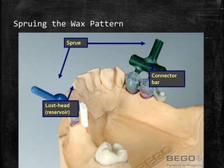 CASTING PROCEDURES AND DEFECTS | PPTX