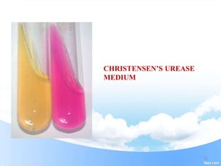 Culture Media History and Types | PPTX