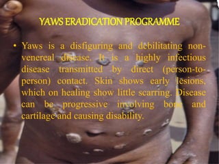 YAWS ERADICATION PROGRAMME
• Yaws is a disfiguring and debilitating non-
venereal disease. It is a highly infectious
disease transmitted by direct (person-to-
person) contact. Skin shows early lesions,
which on healing show little scarring. Disease
can be progressive involving bone and
cartilage and causing disability.
 