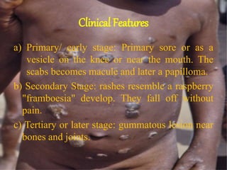 Clinical Features
a) Primary/ early stage: Primary sore or as a
vesicle on the knee or near the mouth. The
scabs becomes macule and later a papilloma.
b) Secondary Stage: rashes resemble a raspberry
"framboesia" develop. They fall off without
pain.
c) Tertiary or later stage: gummatous lesion near
bones and joints.
 