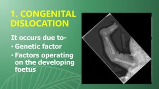 It occurs due to-
• Genetic factor
• Factors operating
on the developing
foetus
1. CONGENITAL
DISLOCATION
 