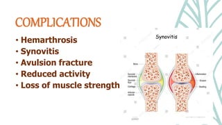 • Hemarthrosis
• Synovitis
• Avulsion fracture
• Reduced activity
• Loss of muscle strength
COMPLICATIONS
 