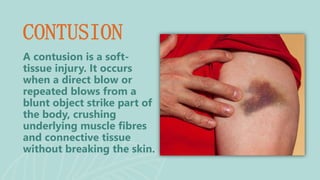 A contusion is a soft-
tissue injury. It occurs
when a direct blow or
repeated blows from a
blunt object strike part of
the body, crushing
underlying muscle fibres
and connective tissue
without breaking the skin.
CONTUSION
 