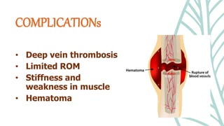 • Deep vein thrombosis
• Limited ROM
• Stiffness and
weakness in muscle
• Hematoma
COMPLICATIONs
 