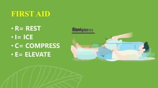• R= REST
• I= ICE
• C= COMPRESS
• E= ELEVATE
FIRST AID
 