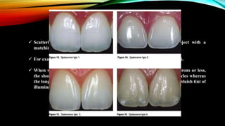 Opalescence Example Shade selection seminar - Copy.pptx