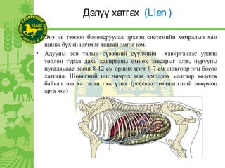 Дэлүү хатгах (Lien )
• Энэ нь тэжээл боловсруулах эрхтэн системийн хямралын хам
шинж бүхий цочмог явцтай эмгэг юм.
• Адууны зөв талын сүвээний сүүлчийн хавирганаас урагш
тоолон гурав дахь хавирганы өмнөх завсарыг олж, нурууны
нугаламаас доош 8-12 см орших цэгт 6-7 см шөвгөөр эгц босоо
хатгана. Шөвөгний иш чичрэх мэт эргэлдэх маягаар хөдөлж
байвал зөв хатгасан гэж үзнэ. (рефлекс эмчилгээний өвөрмөц
арга юм)
 