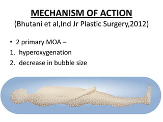 MECHANISM OF ACTION
(Bhutani et al,Ind Jr Plastic Surgery,2012)
• 2 primary MOA –
1. hyperoxygenation
2. decrease in bubble size
 