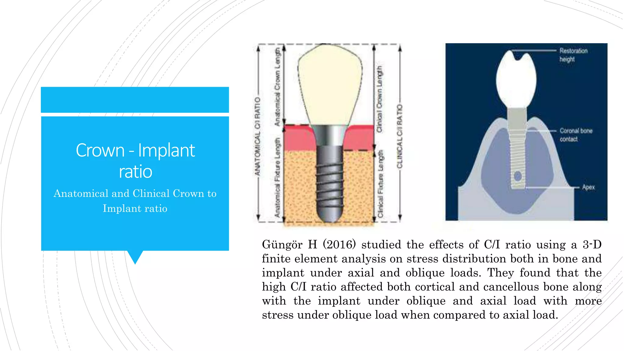 Crown-Implant
ratio
Anatomical and Clinical Crown to
Implant ratio
Güngör H (2016) studied the effects of C/I ratio using a 3-D
finite element analysis on stress distribution both in bone and
implant under axial and oblique loads. They found that the
high C/I ratio affected both cortical and cancellous bone along
with the implant under oblique and axial load with more
stress under oblique load when compared to axial load.
 