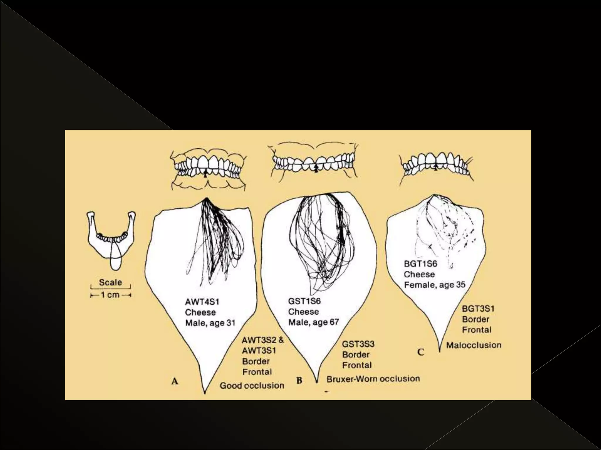 Mandibular movements and determinants | PPTX