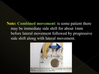 Note: Combined movement: is some patient there
may be immediate side shift for about 1mm
before lateral movement followed by progressive
side shift along with lateral movement.
 