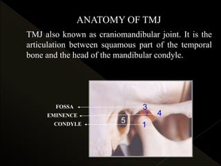ANATOMY OF TMJ
FOSSA
EMINENCE
CONDYLE
TMJ also known as craniomandibular joint. It is the
articulation between squamous part of the temporal
bone and the head of the mandibular condyle.
 