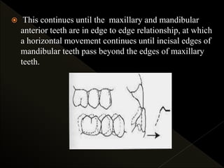  This continues until the maxillary and mandibular
anterior teeth are in edge to edge relationship, at which
a horizontal movement continues until incisal edges of
mandibular teeth pass beyond the edges of maxillary
teeth.
 