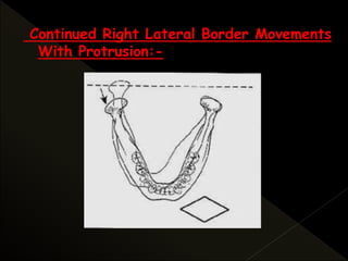 Continued Right Lateral Border Movements
With Protrusion:-
 