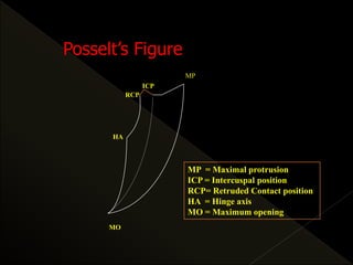 MP
MO
ICP
RCP
HA
MP = Maximal protrusion
ICP = Intercuspal position
RCP= Retruded Contact position
HA = Hinge axis
MO = Maximum opening
Posselt’s Figure
 