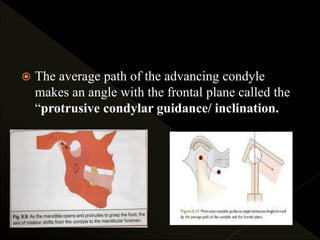 The average path of the advancing condyle
makes an angle with the frontal plane called the
“protrusive condylar guidance/ inclination.
 