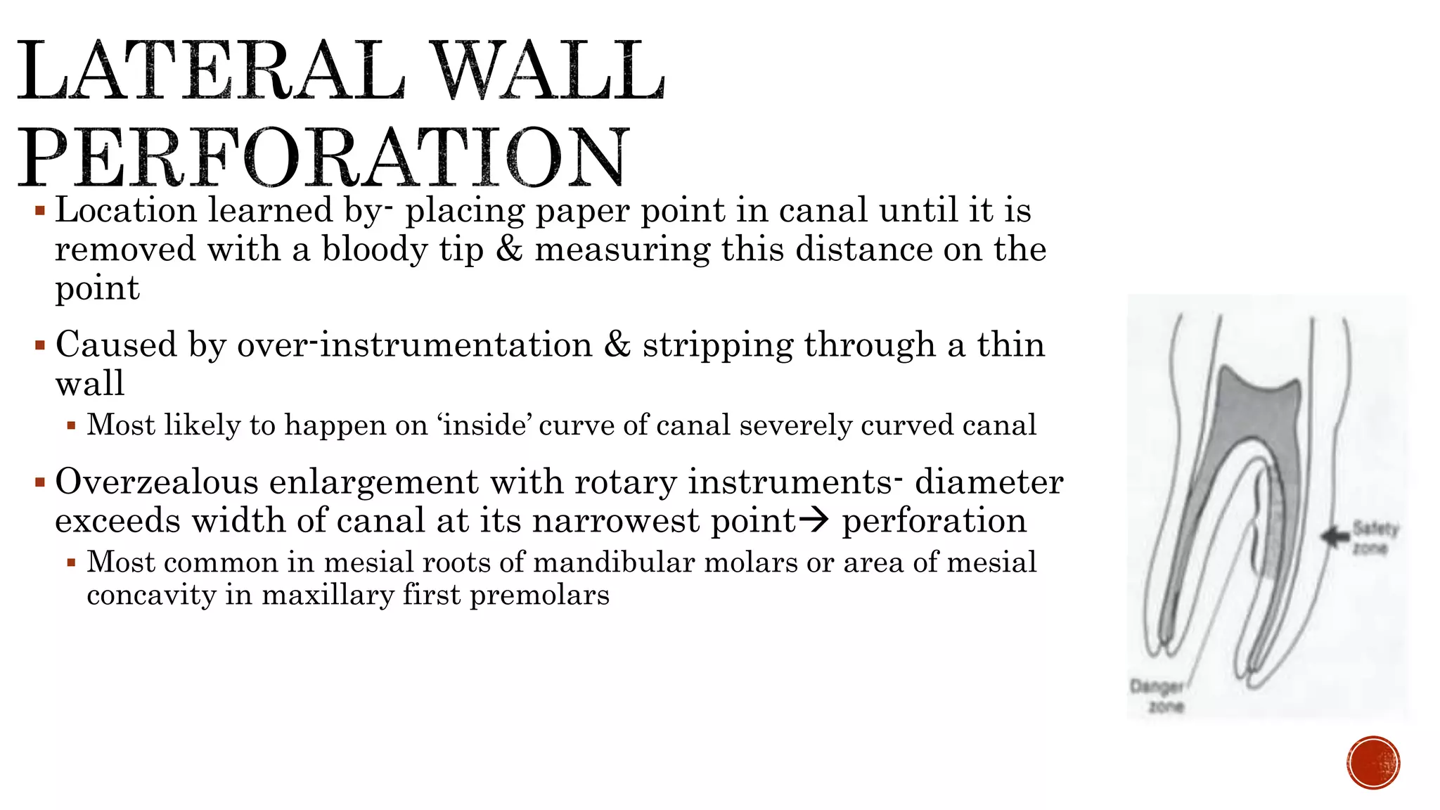  Location learned by- placing paper point in canal until it is
removed with a bloody tip & measuring this distance on the
point
 Caused by over-instrumentation & stripping through a thin
wall
 Most likely to happen on ‘inside’ curve of canal severely curved canal
 Overzealous enlargement with rotary instruments- diameter
exceeds width of canal at its narrowest point perforation
 Most common in mesial roots of mandibular molars or area of mesial
concavity in maxillary first premolars
 