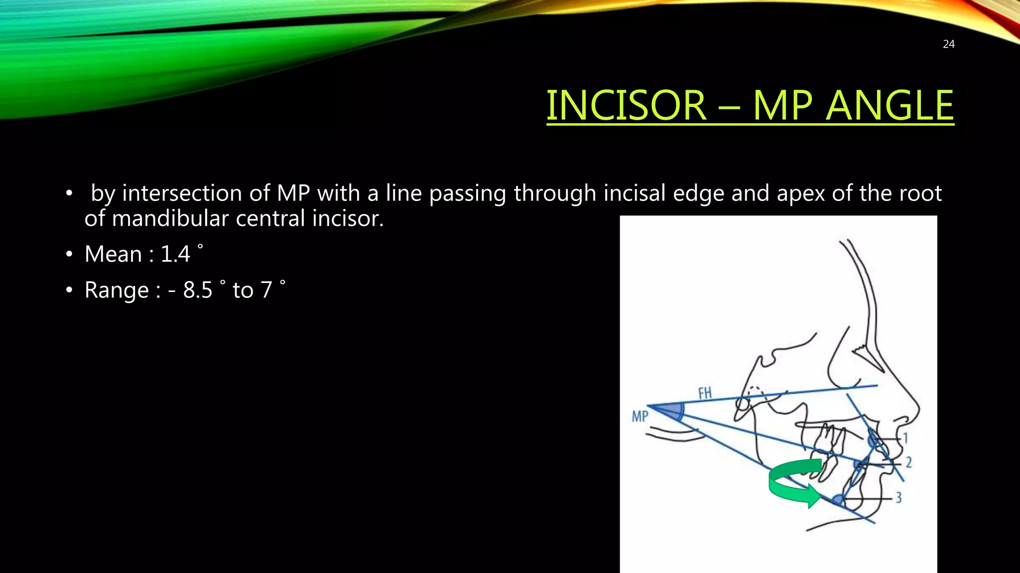 INCISOR – MP ANGLE
• by intersection of MP with a line passing through incisal edge and apex of the root
of mandibular central incisor.
• Mean : 1.4 ˚
• Range : - 8.5 ˚ to 7 ˚
24
 