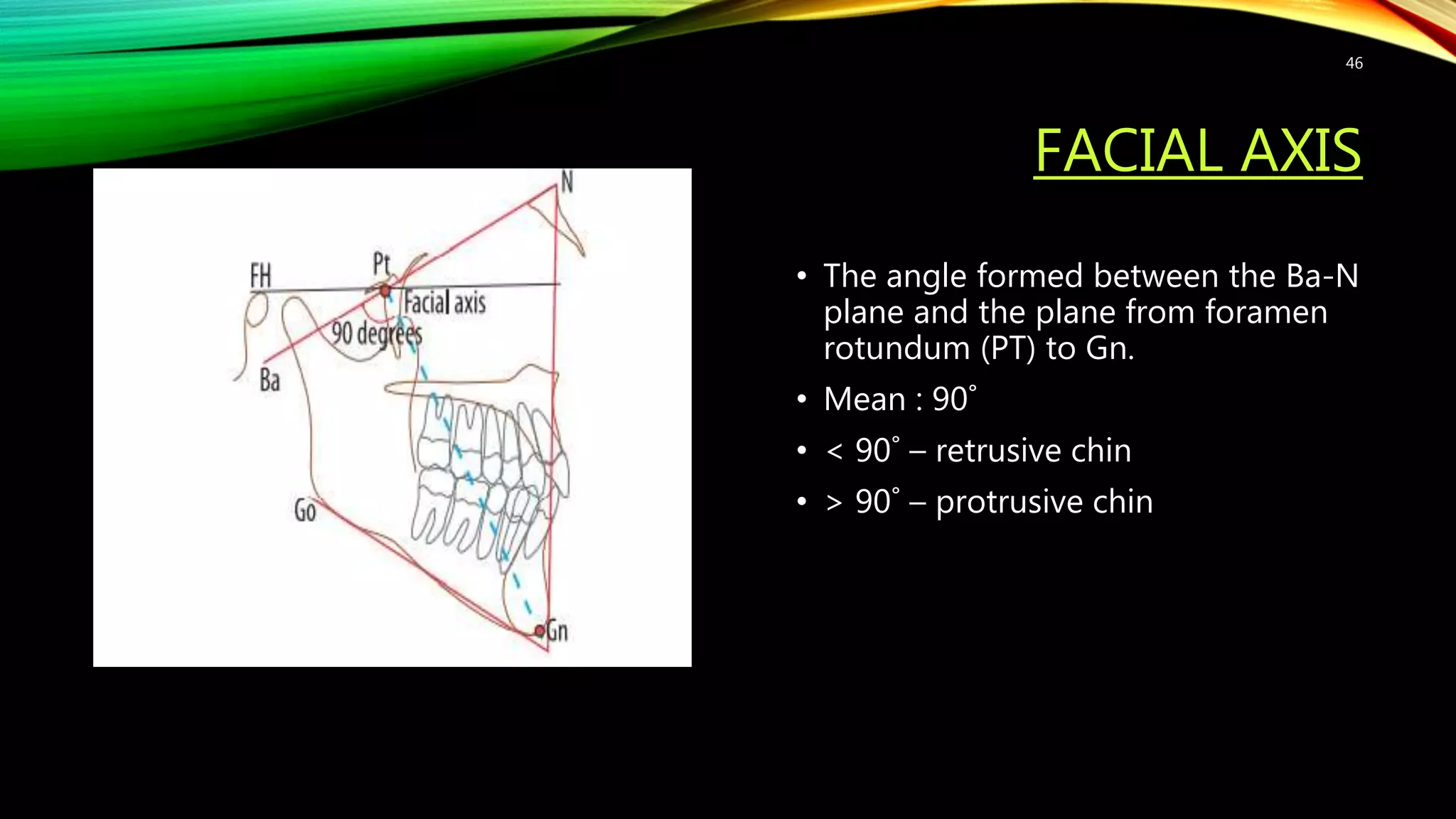 FACIAL AXIS
• The angle formed between the Ba-N
plane and the plane from foramen
rotundum (PT) to Gn.
• Mean : 90˚
• < 90˚ – retrusive chin
• > 90˚ – protrusive chin
46
 
