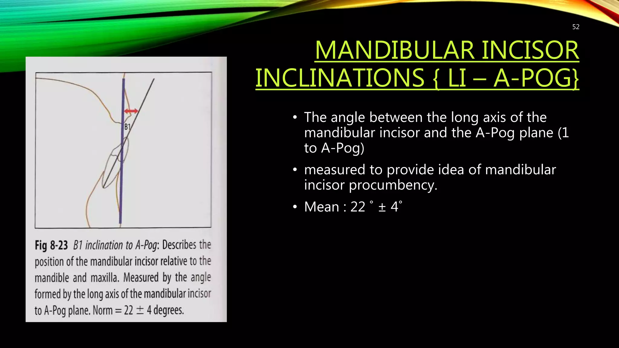 MANDIBULAR INCISOR
INCLINATIONS { LI – A-POG}
• The angle between the long axis of the
mandibular incisor and the A-Pog plane (1
to A-Pog)
• measured to provide idea of mandibular
incisor procumbency.
• Mean : 22 ˚ ± 4˚
52
 