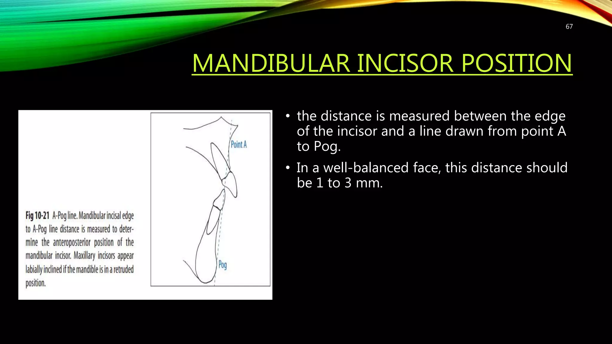 MANDIBULAR INCISOR POSITION
• the distance is measured between the edge
of the incisor and a line drawn from point A
to Pog.
• In a well-balanced face, this distance should
be 1 to 3 mm.
67
 