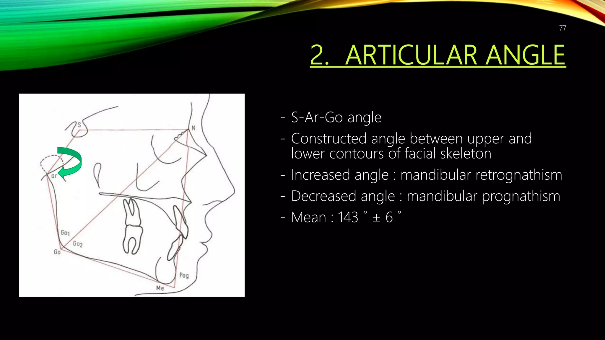 2. ARTICULAR ANGLE
- S-Ar-Go angle
- Constructed angle between upper and
lower contours of facial skeleton
- Increased angle : mandibular retrognathism
- Decreased angle : mandibular prognathism
- Mean : 143 ˚ ± 6 ˚
77
 