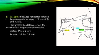 B. Ar- ptm : measures horizontal distance
between posterior aspects of mandible
and maxilla.
- The greater the distance , more the
mandible will lie posteriorly to maxilla.
males : 37.1 ± 2 mm
females : 32.8 ± 1.9 mm
100
 