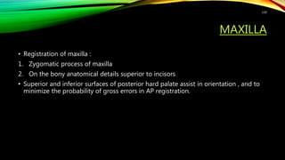 MAXILLA
• Registration of maxilla :
1. Zygomatic process of maxilla
2. On the bony anatomical details superior to incisors
• Superior and inferior surfaces of posterior hard palate assist in orientation , and to
minimize the probability of gross errors in AP registration.
130
 