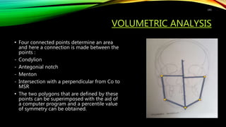 VOLUMETRIC ANALYSIS
• Four connected points determine an area
and here a connection is made between the
points :
- Condylion
- Antegonial notch
- Menton
- Intersection with a perpendicular from Co to
MSR
• The two polygons that are defined by these
points can be superimposed with the aid of
a computer program and a percentile value
of symmetry can be obtained.
143
 