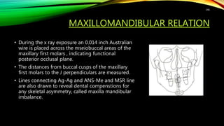 MAXILLOMANDIBULAR RELATION
• During the x ray exposure an 0.014 inch Australian
wire is placed across the mseiobuccal areas of the
maxillary first molars , indicating functional
posterior occlusal plane.
• The distances from buccal cusps of the maxillary
first molars to the J perpendiculars are measured.
• Lines connecting Ag-Ag and ANS-Me and MSR line
are also drawn to reveal dental compenstions for
any skeletal asymmetry, called maxilla mandibular
imbalance.
146
 