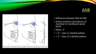 ANB
• Difference between SNA & SNB
• antero-posterior discrepancy of
maxillary to mandibular apical
bases
• Mean : 2˚
• > 2˚ – class 11 skeletal pattern
• < 2˚ – class 111 skeletal pattern
30
 