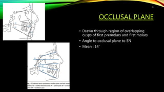 OCCLUSAL PLANE
• Drawn through region of overlapping
cusps of first premolars and first molars
• Angle to occlusal plane to SN
• Mean : 14˚
31
 