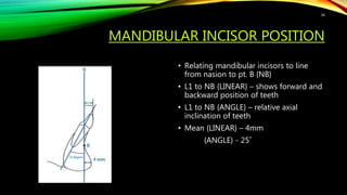 MANDIBULAR INCISOR POSITION
• Relating mandibular incisors to line
from nasion to pt. B {NB}
• L1 to NB {LINEAR} – shows forward and
backward position of teeth
• L1 to NB {ANGLE} – relative axial
inclination of teeth
• Mean {LINEAR} – 4mm
{ANGLE} - 25˚
34
 