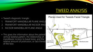 TWEED ANALYSIS
• Tweed’s diagnostic triangle :
1. FRANKFORT MANDIBULAR PLANE ANGLE
2. FRANKFORT MANDIBULAR INCISOR ANGLE
3. INCISOR MANDIBULAR PLANE ANGLE
• This gives the information about the patient’s
vertical skeletal pattern, the relationship of
mandibular incisors to basal bone, and the
relative amount of protrusion, or lack thereof,
of the face.
39
 