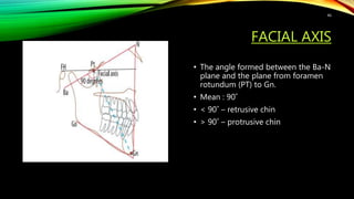 FACIAL AXIS
• The angle formed between the Ba-N
plane and the plane from foramen
rotundum (PT) to Gn.
• Mean : 90˚
• < 90˚ – retrusive chin
• > 90˚ – protrusive chin
46
 