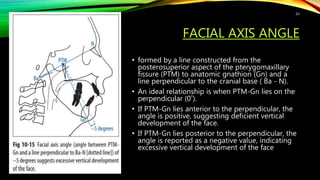 FACIAL AXIS ANGLE
• formed by a line constructed from the
posterosuperior aspect of the pterygomaxillary
fissure (PTM) to anatomic gnathion (Gn) and a
line perpendicular to the cranial base ( Ba - N).
• An ideal relationship is when PTM-Gn lies on the
perpendicular (0˚).
• If PTM-Gn lies anterior to the perpendicular, the
angle is positive, suggesting deficient vertical
development of the face.
• If PTM-Gn lies posterior to the perpendicular, the
angle is reported as a negative value, indicating
excessive vertical development of the face
63
 