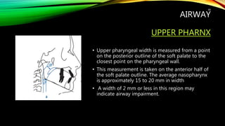 AIRWAY
UPPER PHARNX
• Upper pharyngeal width is measured from a point
on the posterior outline of the soft palate to the
closest point on the pharyngeal wall.
• This measurement is taken on the anterior half of
the soft palate outline. The average nasopharynx
is approximately 15 to 20 mm in width
• A width of 2 mm or less in this region may
indicate airway impairment.
68
 