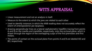 WITS APPRAISAL
• Linear measurement and not an analysis in itself.
• Measure to the extent to which the jaws are related to each other
• Used to identify instances in which the ANB reading does not accurately reflect the
extent of anteroposterior jaw dysplasia.
• drawing perpendicular lines on a lateral cephalometric headfilm tracing from points
A and B on the maxilla and mandible, respectively, onto the occlusal plane, which is
drawn through the region of the overlapping cusps of the first premolars and first
molars.
• The points of contact on the occlusal plane from points A and B are labeled AO and
BO, respectively
71
 