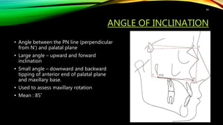 ANGLE OF INCLINATION
• Angle between the PN line (perpendicular
from N’) and palatal plane
• Large angle – upward and forward
inclination
• Small angle – downward and backward
tipping of anterior end of palatal plane
and maxillary base.
• Used to assess maxillary rotation
• Mean : 85˚
84
 