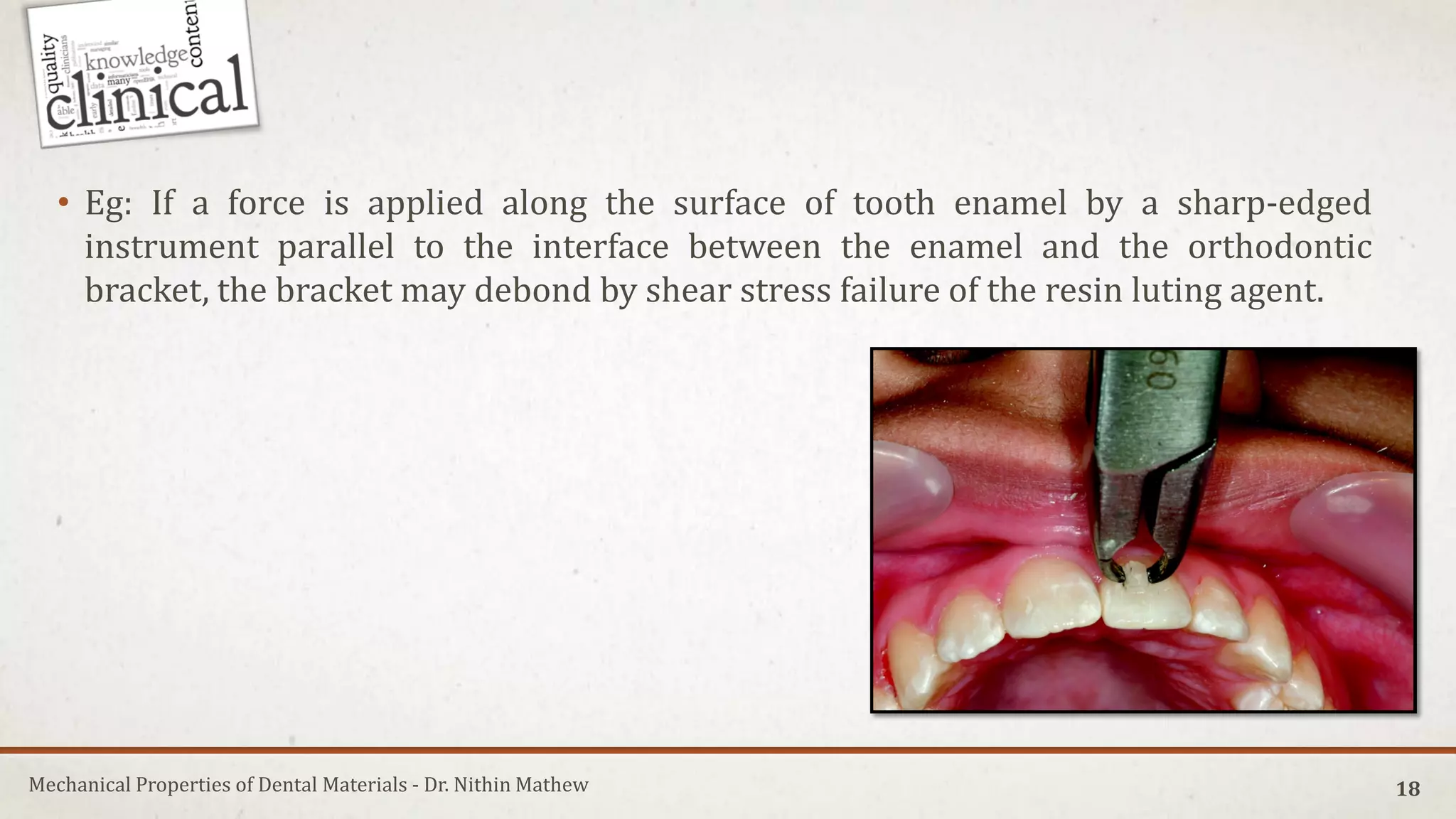 Edged Instrument Mechanical Properties of Dental Materials | PDF