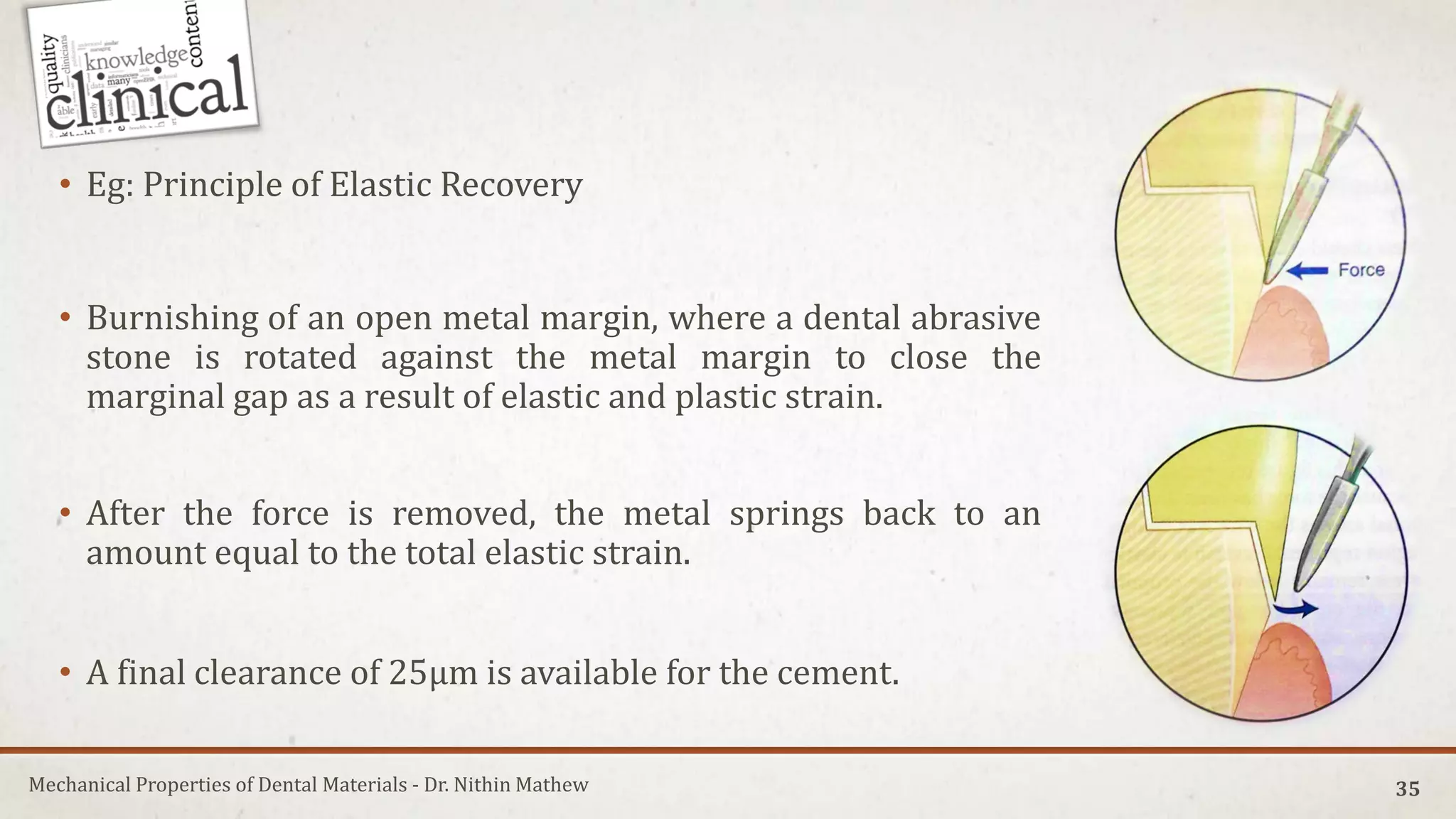 Marginal Opening Mechanical Properties of Dental Materials | PDF