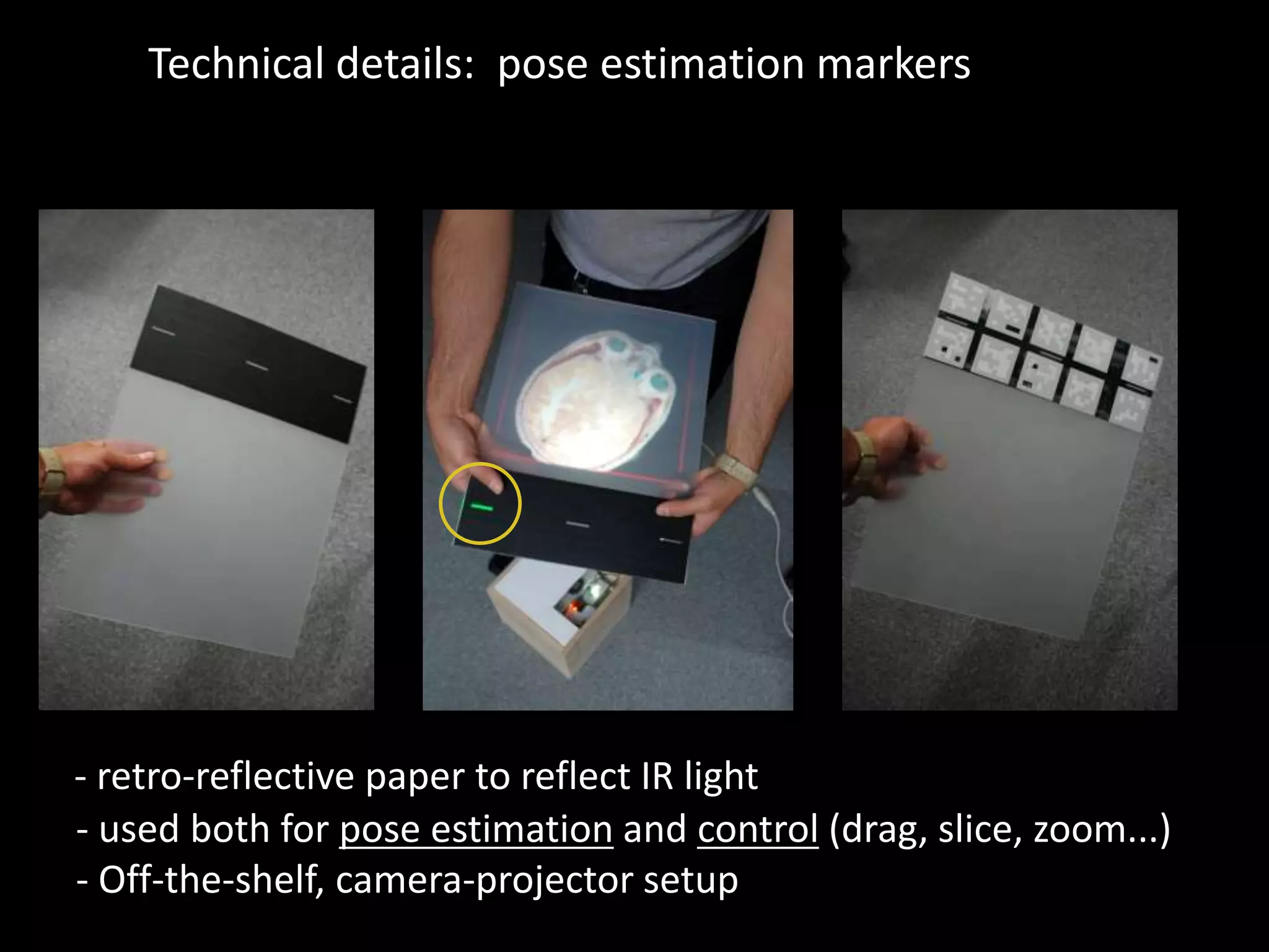 - retro-reflective paper to reflect IR light
Technical details: pose estimation markers
- used both for pose estimation and control (drag, slice, zoom...)
- Off-the-shelf, camera-projector setup
 