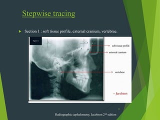 Tracing Radiograph seminar4cephintro-230320190937-35f6e0cb.pdf