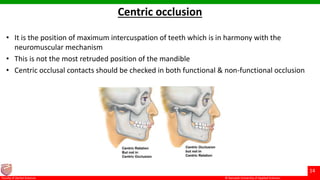 © Ramaiah University of Applied Sciences
14
Faculty of Dental Sciences
Centric occlusion
• It is the position of maximum intercuspation of teeth which is in harmony with the
neuromuscular mechanism
• This is not the most retruded position of the mandible
• Centric occlusal contacts should be checked in both functional & non-functional occlusion
 