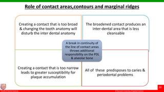 © Ramaiah University of Applied Sciences
20
Faculty of Dental Sciences
Role of contact areas,contours and marginal ridges
Creating a contact that is too broad
& changing the tooth anatomy will
disturb the inter dental anatomy
The broadened contact produces an
inter-dental area that is less
cleansable
Creating a contact that is too narrow
leads to greater susceptibility for
plaque accumulation
All of these predisposes to caries &
periodontal problems
A break in continuity of
the line of contact areas
throws additional
responsibility on the PDL
& alveolar bone
 