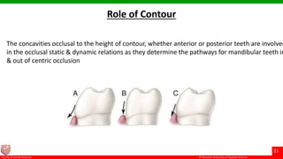 © Ramaiah University of Applied Sciences
21
Faculty of Dental Sciences
Role of Contour
The concavities occlusal to the height of contour, whether anterior or posterior teeth are involved
in the occlusal static & dynamic relations as they determine the pathways for mandibular teeth in
& out of centric occlusion
 