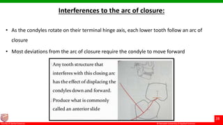 © Ramaiah University of Applied Sciences
28
Faculty of Dental Sciences
Interferences to the arc of closure:
• As the condyles rotate on their terminal hinge axis, each lower tooth follow an arc of
closure
• Most deviations from the arc of closure require the condyle to move forward
 