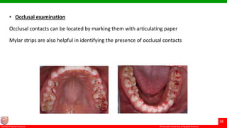 © Ramaiah University of Applied Sciences
38
Faculty of Dental Sciences
• Occlusal examination
Occlusal contacts can be located by marking them with articulating paper
Mylar strips are also helpful in identifying the presence of occlusal contacts
 