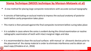 © Ramaiah University of Applied Sciences
51
Faculty of Dental Sciences
Stamp Technique (MOOS technique by Maroun-Motawie et al)
• A new method for placing large composite restorations with accurate occlusal topography
• It consists of fabricating an occlusal matrix to impress the occlusal anatomy of posterior
teeth before cavity preparation takes place
• This matrix is then pressed against the final composite increment before curing takes place
• It is suitable in cases where the caries is evident during the clinical examination or routine
radiographic examination of teeth with intact marginal ridges and idea
• It is recommended to clean the occlusal surfaces with manual or ultrasonic devices prior to
the placement of the stamp material in order to eliminate interference and to obtain an
exact copy (Chiodera et al., 2016)
 